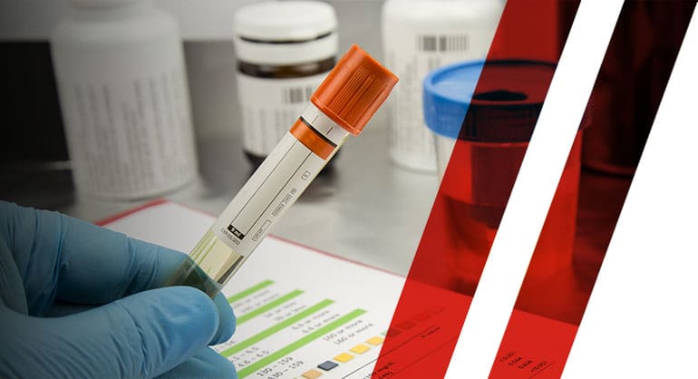 Pre-Employment Drug Testing After Cannabis Legalization in Canada: What’s Really Changed, and What Employers Must Know